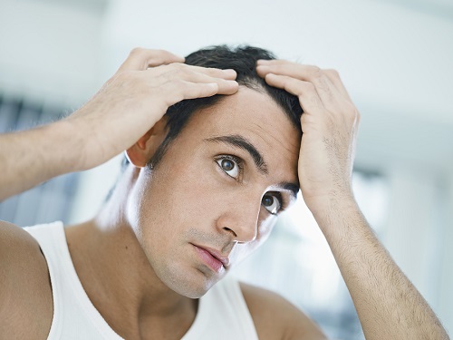 درمان ریزش موی آقایان