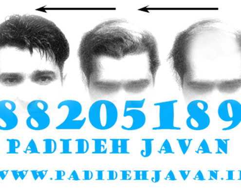 ترمیم مو